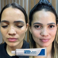 Face Cleam 30g Original - Renove Sua Pele e Diga Adeus às Imperfeições - Oferta Especial+ Frete Grátis