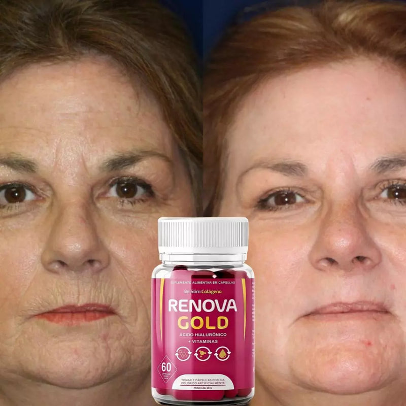 Renova Gold 60cps Original: A Revolução Dourada Para a Sua Beleza - ESCOLHA ABAIXO A SUA OFERTA - 2 ou 4 FRASCOS - FRETE GRÁTIS